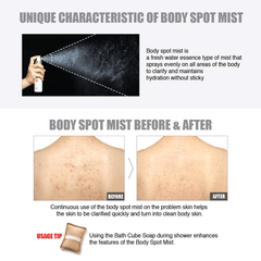 so natural Centel Teatree Body Spot Mist - eCosmeticWorld